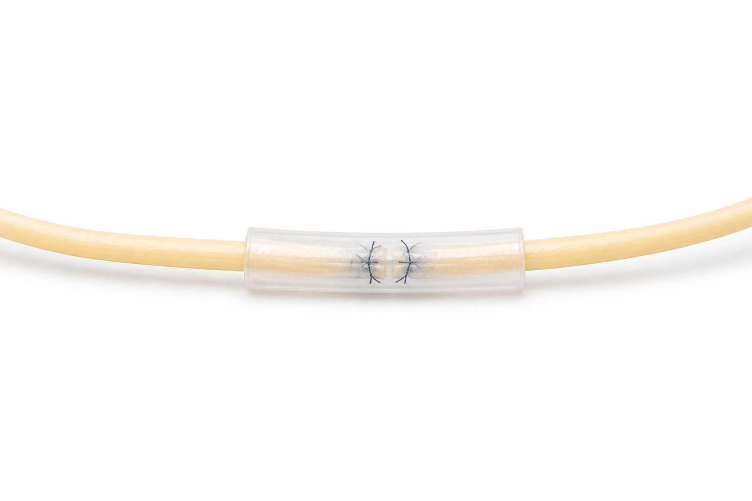 Nerve repair conduit / sheath with microsurgical sutures protecting a coapted nerve